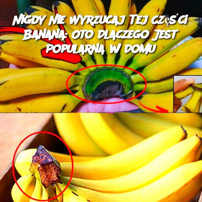 Nigdy Nie Wyrzucaj Tej Części Banana: Oto Dlaczego Jest Popularna w Domu