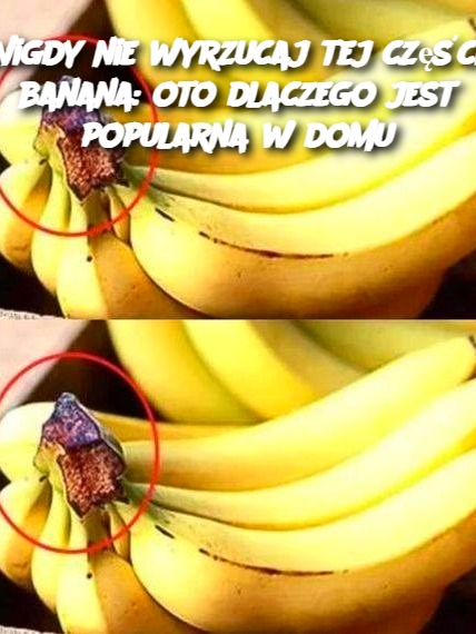 Nigdy nie wyrzucaj tej części banana: oto dlaczego jest popularna w domu