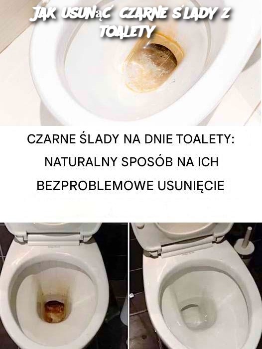 Jak usunąć czarne ślady z toalety?