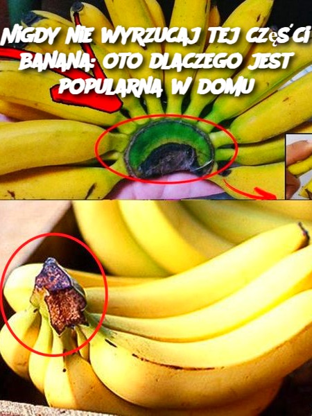 Nigdy nie wyrzucaj tej części banana: oto dlaczego jest popularna w domu