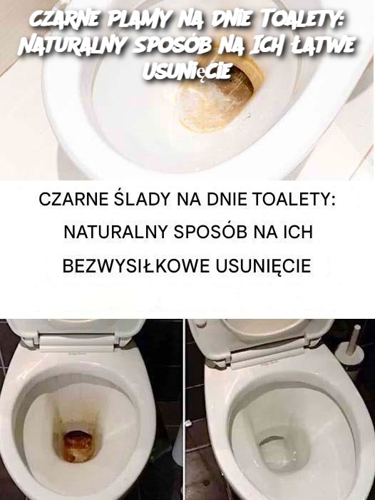 Czarne Plamy na Dnie Toalety: Naturalny Sposób na Ich Łatwe Usunięcie