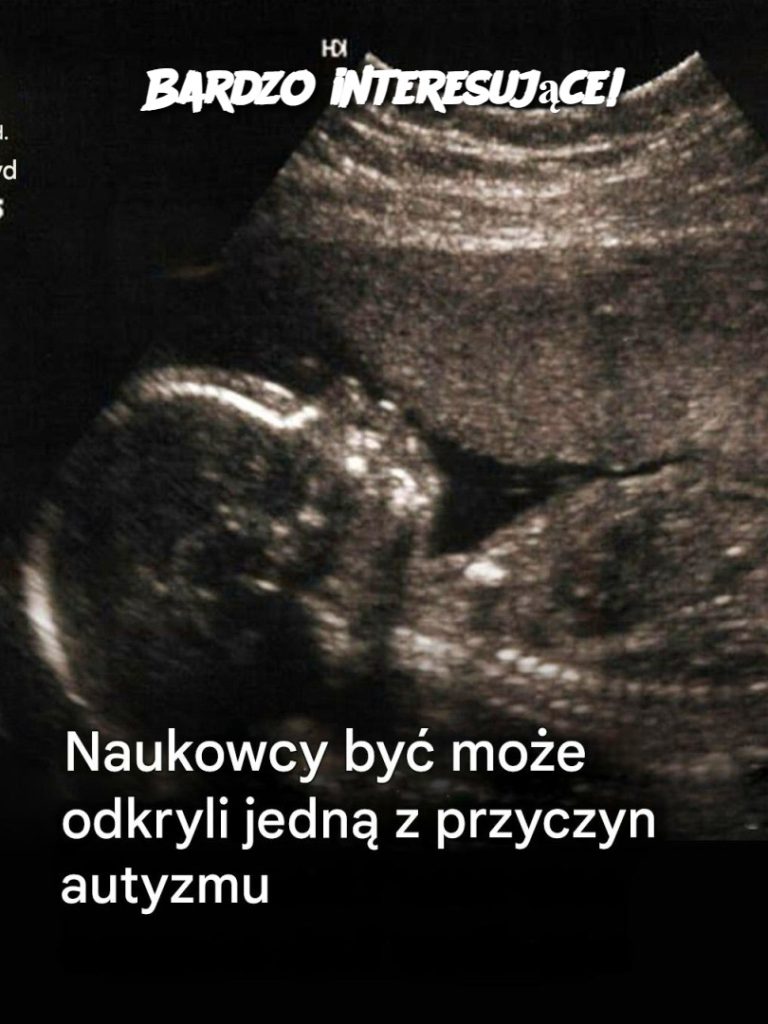Bardzo interesujące!