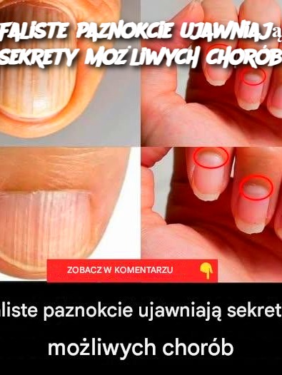 Faliste paznokcie ujawniają sekrety możliwych chorób