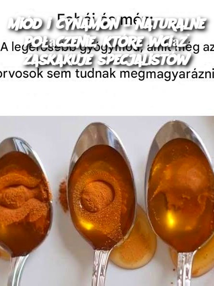 Miód i cynamon – naturalne połączenie, które wciąż zaskakuje specjalistów