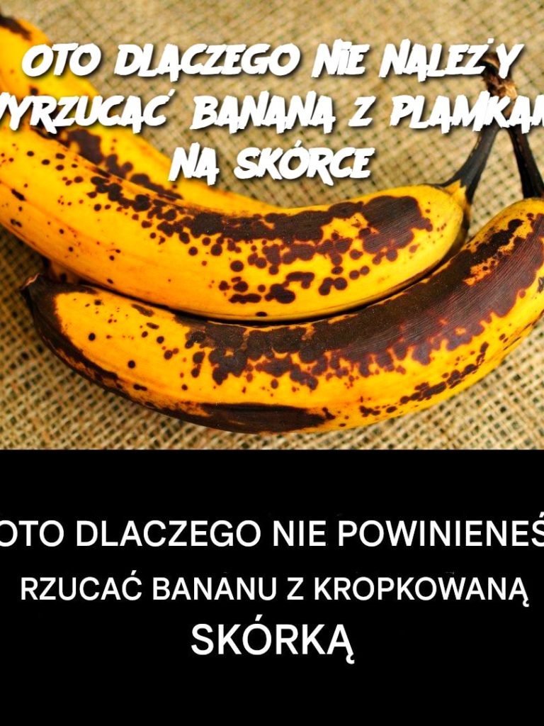 Oto dlaczego nie należy wyrzucać banana z plamkami na skórce