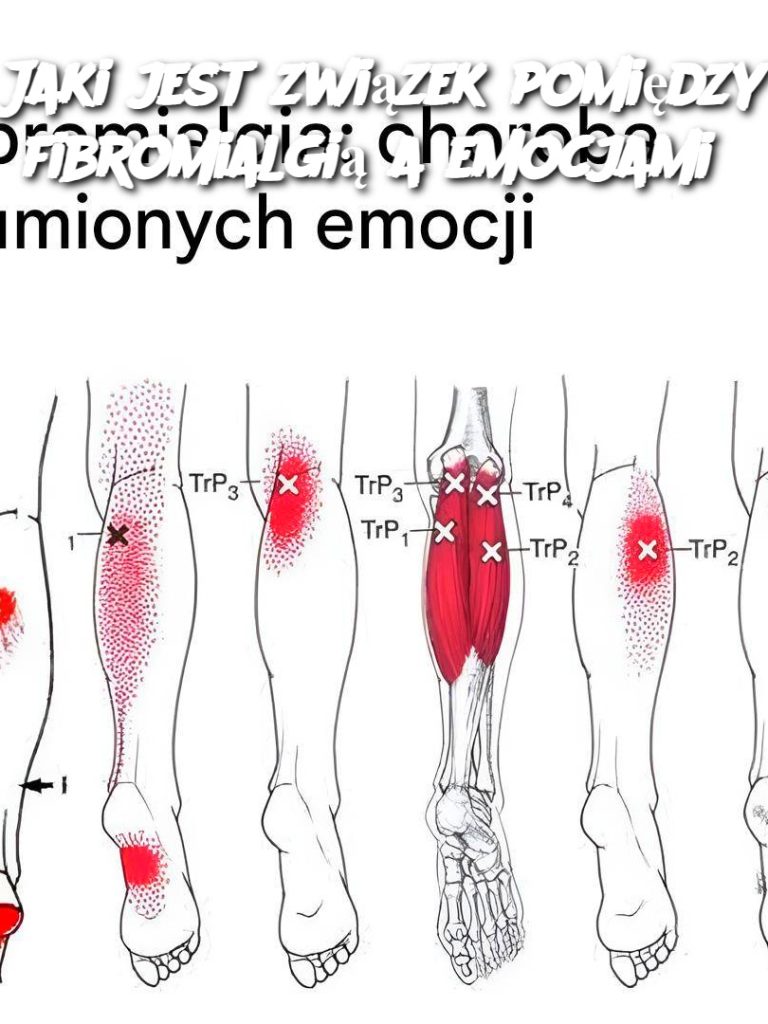Jaki jest związek pomiędzy fibromialgią a emocjami?